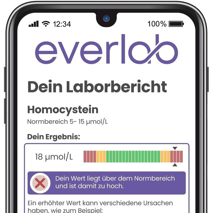 Тест на гомоцистеїн EVERLAB - перевірте рівень гомоцистеїну швидко та легко Рання діагностика серцево-судинних захворювань Самотест для домашнього використання