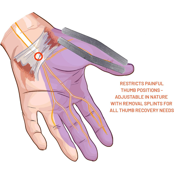 Повсякденний медичний бандаж для великого пальця та шина для великого пальця з бандажем для лікування синдрому зап'ястного каналу, артриту, тендовагініту з опорою на зап'ястя Бандажі на зап'ястя для лівої або правої руки