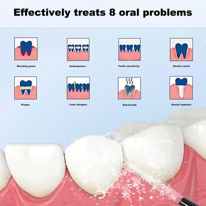 Бездротовий іригатор для порожнини рота, переможець тестування іригатора порожнини рота Annmiir 2023 року з 4 режимами очищення 8 змінних насадок, що обертаються на 360, портативний стоматологічний іригатор 310 мл IPX7 водонепроникний, для дому та подорож