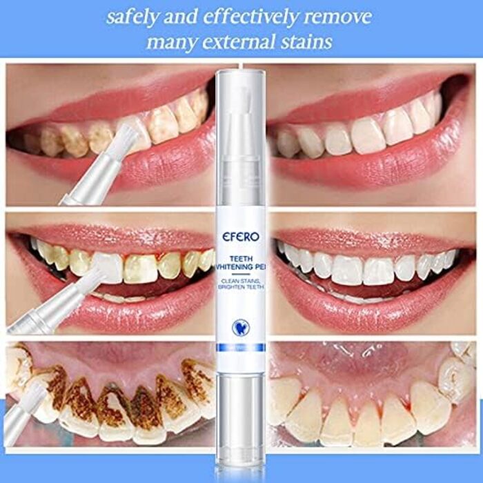 Рідина для чищення EFERO Teeth Whitening Pen видаляє плями нальоту, Жовте відбілювання зубів, Гігієна порожнини рота, Ручка для відбілювання зубів