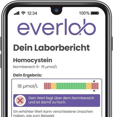 Тест на гомоцистеїн EVERLAB - перевірте рівень гомоцистеїну швидко та легко Рання діагностика серцево-судинних захворювань Самотест для домашнього використання