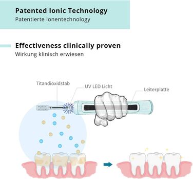 Звукова електрична зубна щітка/запатентована зубна щітка Ion (до 31 000 рухів щітки / хвилина) з Японії для електрика. Ionic & Чищення зубів і догляд за яснами - Денний білий