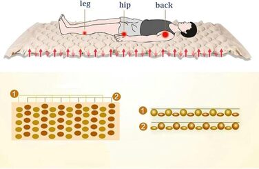 Надувний матрац проти пролежнів, протипролежневий матрац підходить для пролежнів і пролежнів