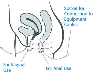 Внутрішньоанальний та малий інтравагінальний зонд, тазове дно, комфортна стимуляція м'язів, зміцнення м'язів, використання для одного пацієнта