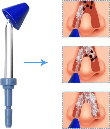 Насадки для промивання носа для іригатора порожнини рота Waterpik Wp-100 Wp-450 Wp-250 Wp-300 Wp-660 Wp-900 OF (6 упаковок) 6 насадок для іригатора носа