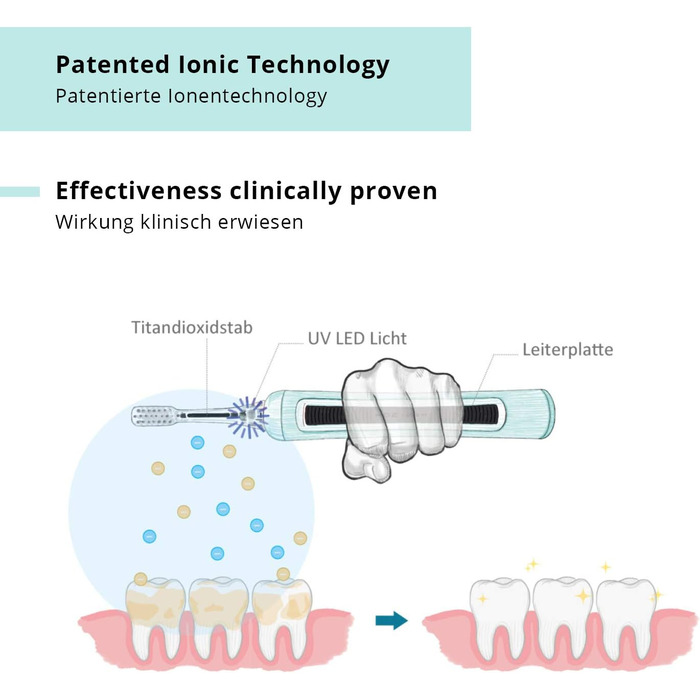 Звукова електрична зубна щітка/запатентована зубна щітка Ion (до 31 000 рухів щітки / хвилина) з Японії для електрика. Ionic & Чищення зубів і догляд за яснами - Денний білий